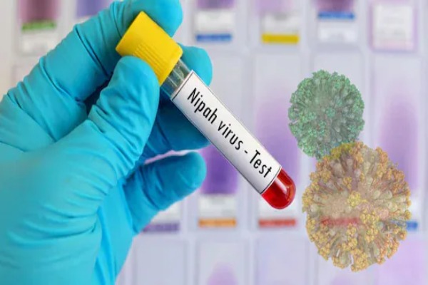 Nipah Virüsü: Belirtileri, Bulaşma Yolları ve Korunma Y